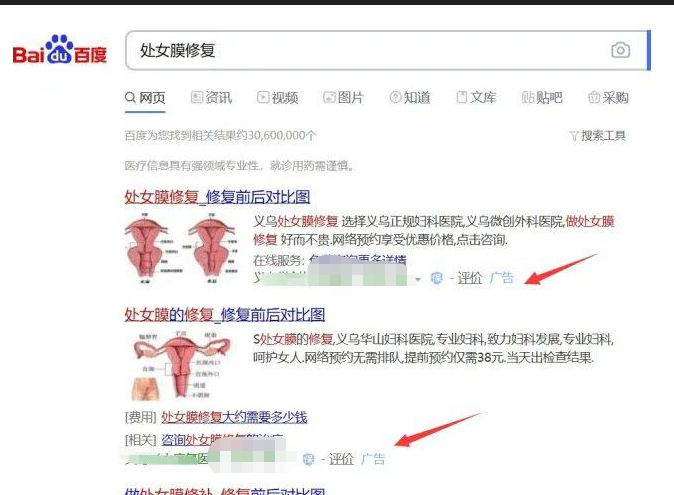 挖掘月入4万+赚钱的偏门灰色项目(2)